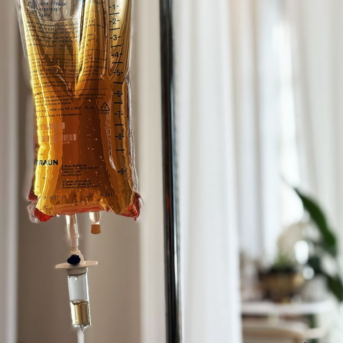 An amber-coloured iron infusion IV drip bag hanging from a stand in a bright, softly lit room.