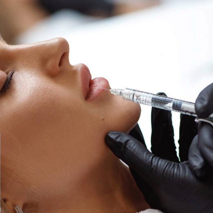Gloved medical practitioner administering dermal filler to a woman's lips with a syringe