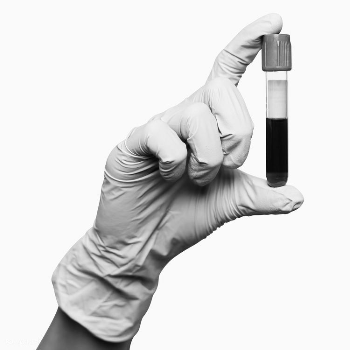 A gloved hand holding a blood sample tube against a white background.