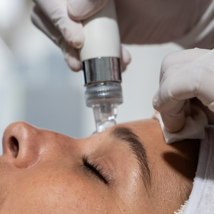 A close-up of a microneedling device being used on a client's forehead during a Dr. Barbara Sturm Super Anti-Ageing Facial, delivered by a gloved practitioner.
