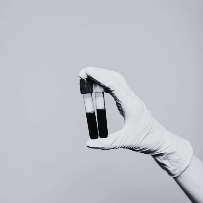 A gloved hand holding two blood sample tubes against a grey background.