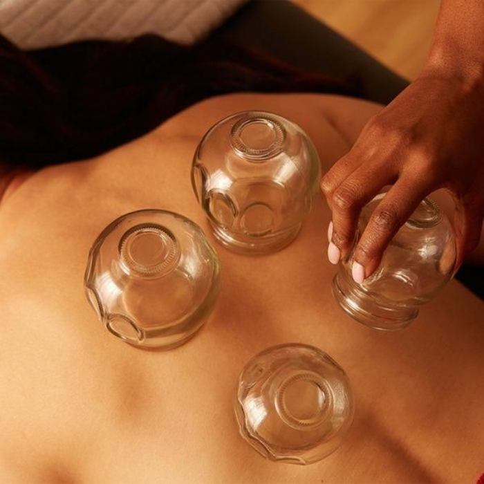 A therapist placing glass cupping cups on a person's back during a cupping massage treatment.