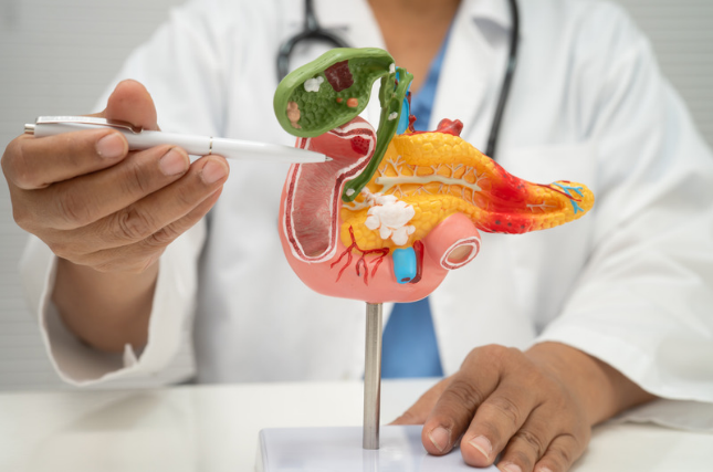 Pancreatic cancer
