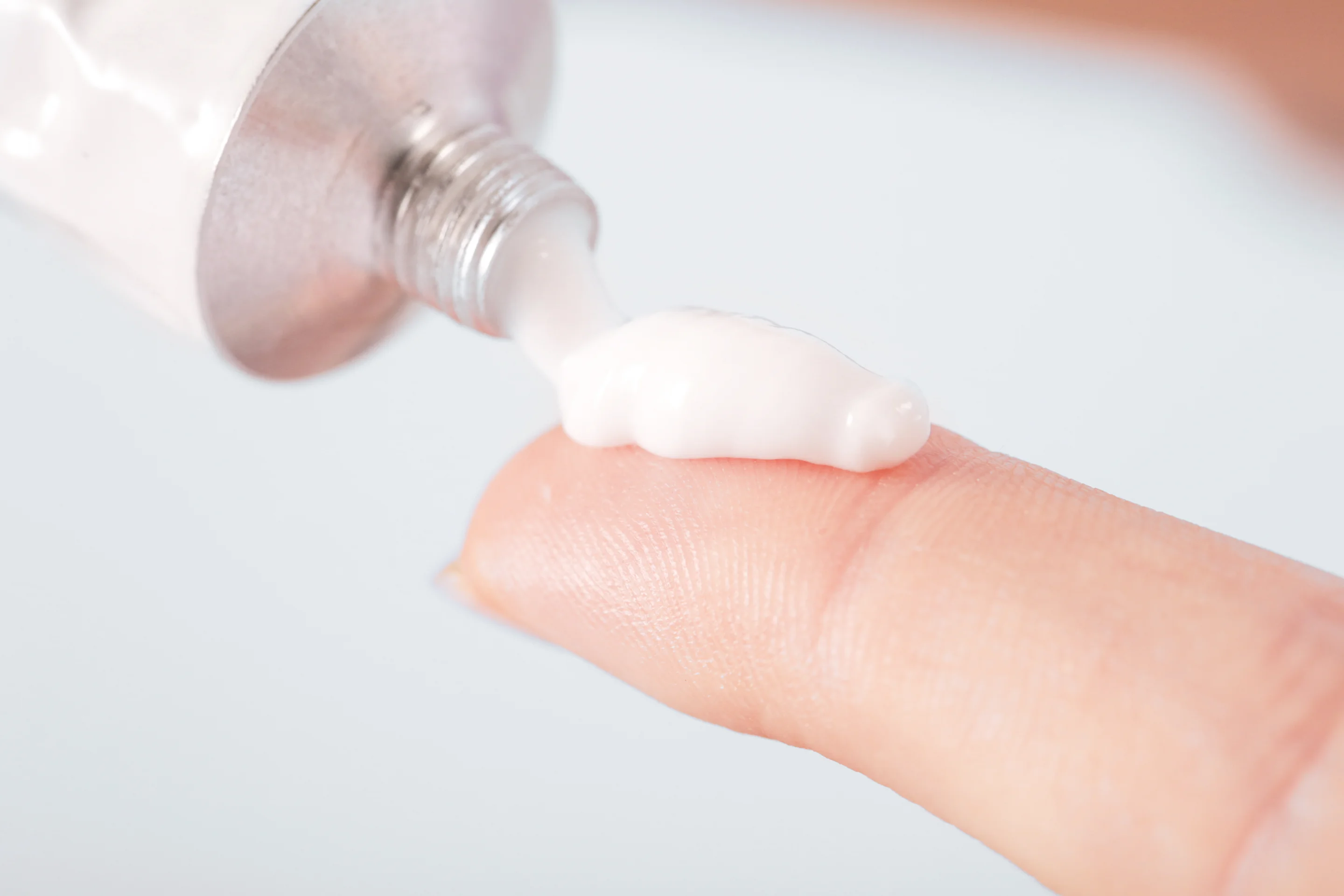 Hämorrhoiden-Salbe wird aus einer Tube auf die Fingerspitze gedrückt.