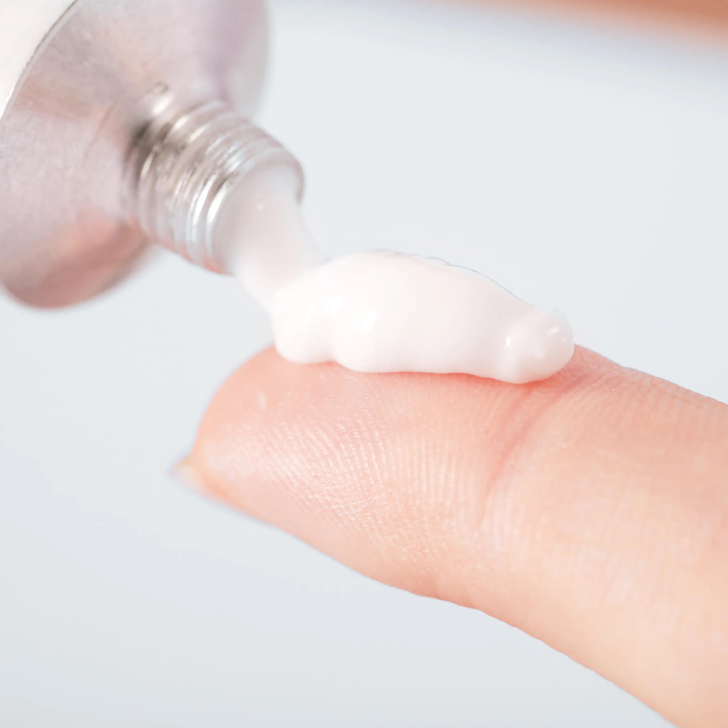 Hämorrhoiden-Salbe wird aus einer Tube auf die Fingerspitze gedrückt.