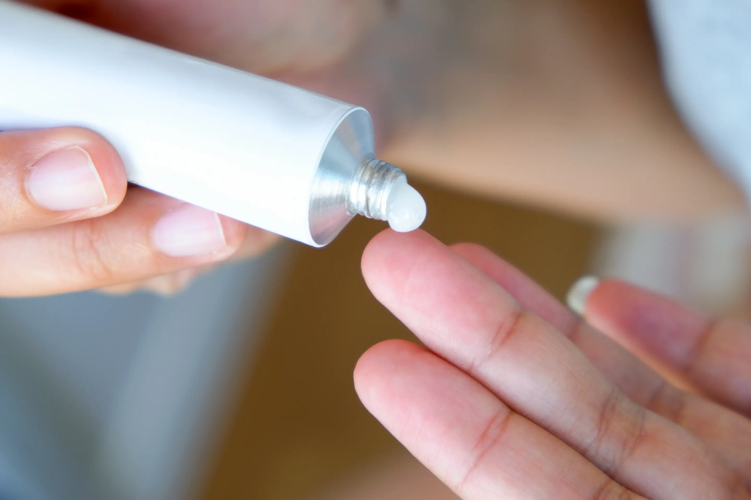 Eine Hand drückt aus einer Tube etwas Hämorrhoiden-Salbe mit Lidocain auf die Fingerspitze der anderen Hand.