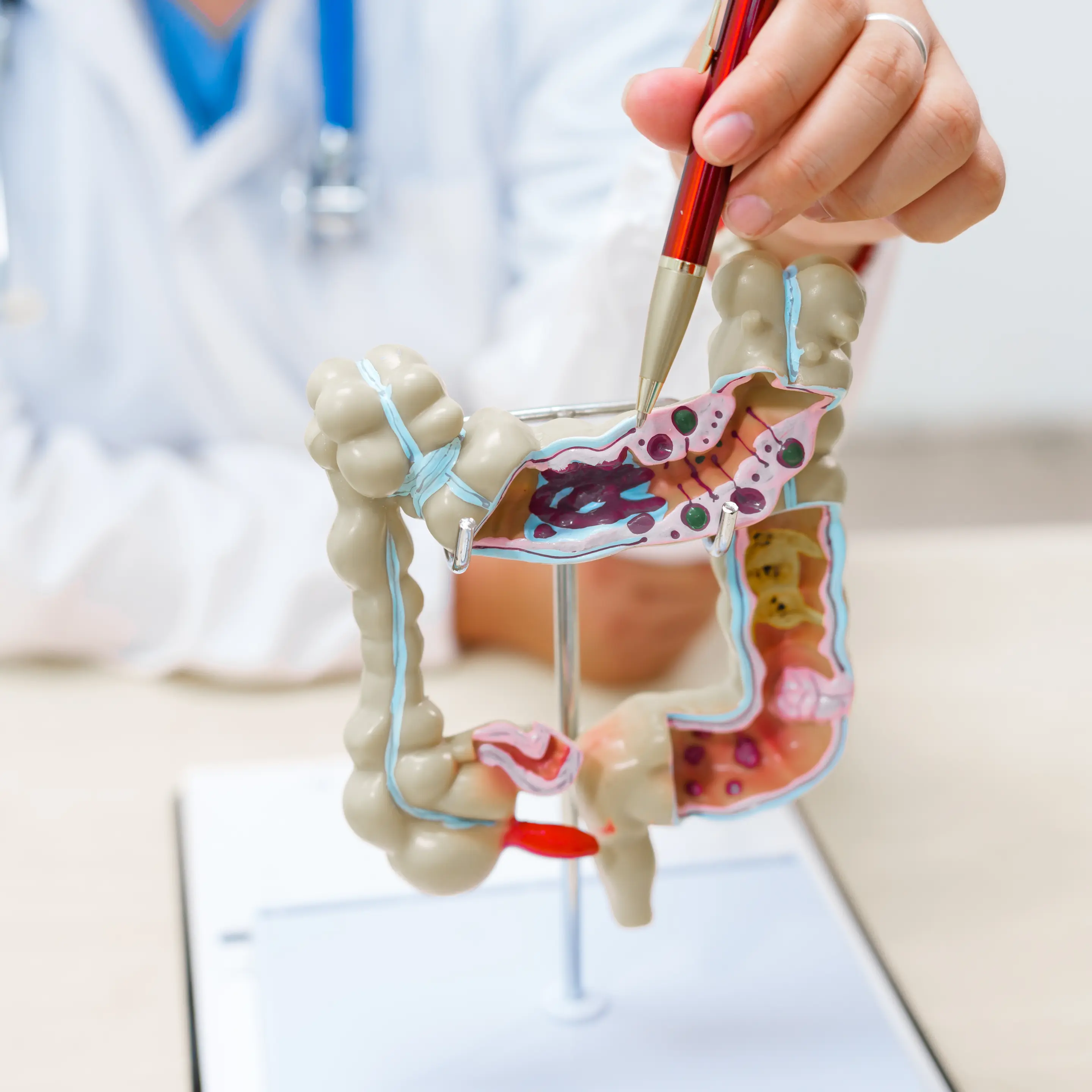 Arzt oder Ärztin zeigt mit einem Stift auf ein anatomisches Modell des Darms.