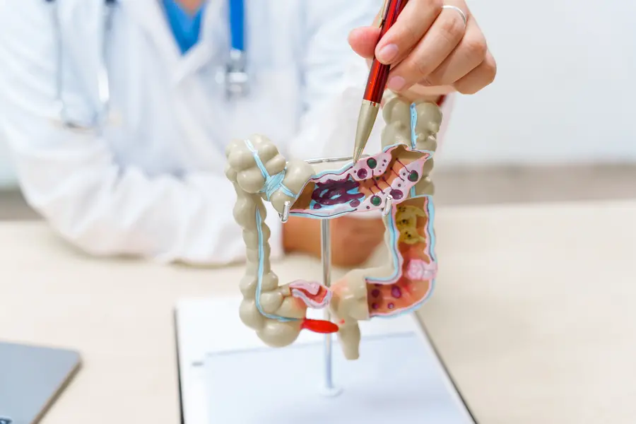 Arzt oder Ärztin zeigt mit einem Stift auf ein anatomisches Modell des Darms.