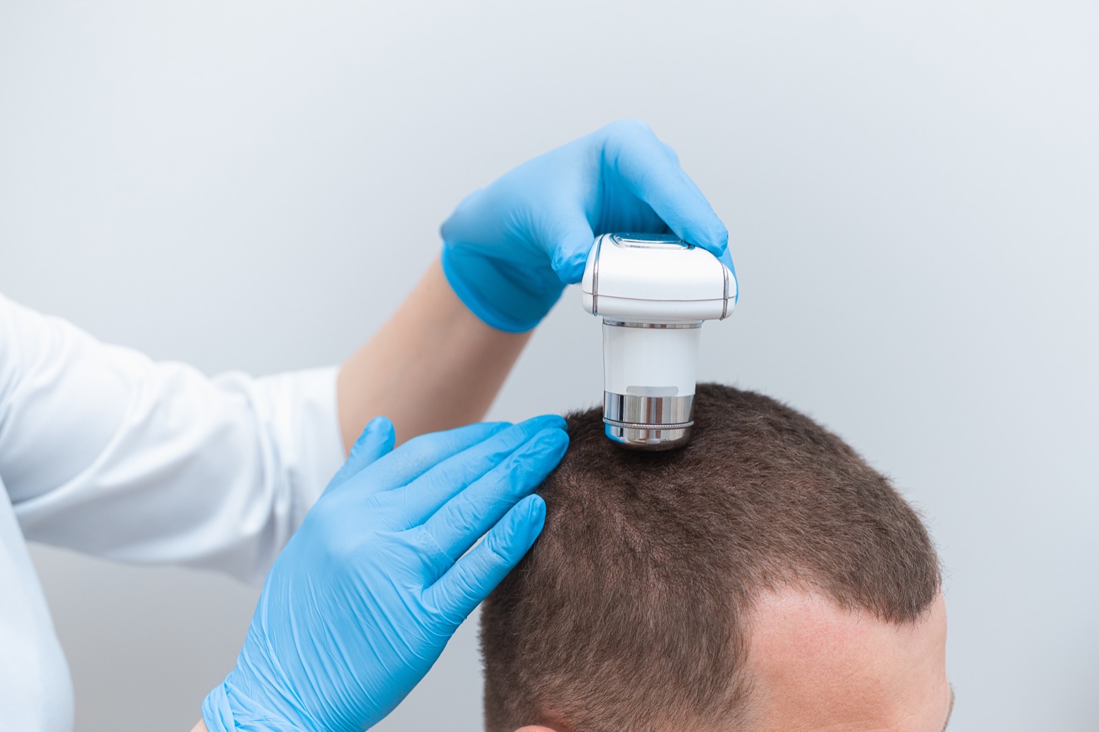 Trichoscopy assessment of hair and scalp