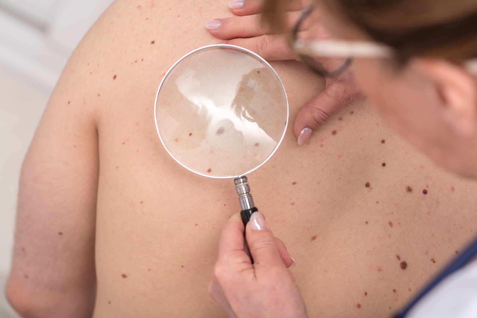 Dermatologist examining a patient's skin