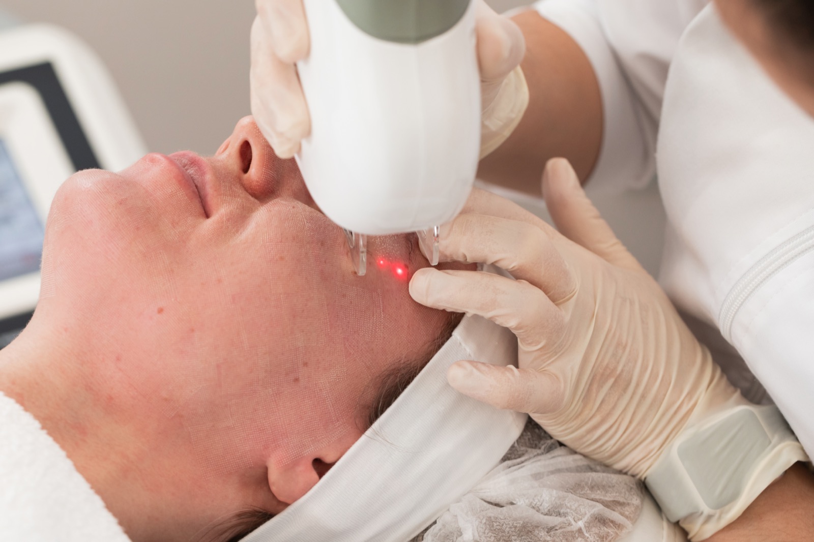 Laser treatment in a clinical setting