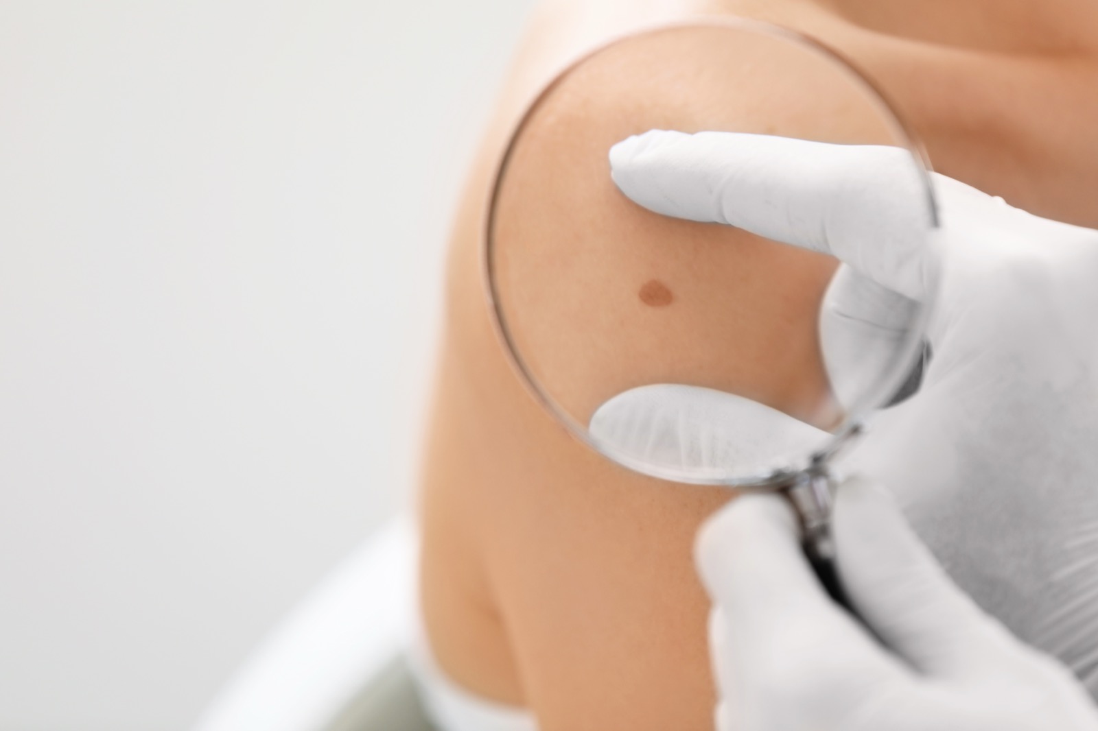 Close examination of a skin lesion
