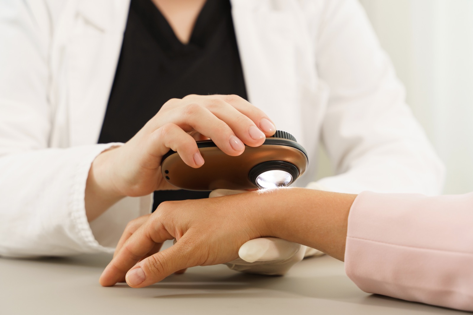 Dermatologist examining skin with a dermatoscope