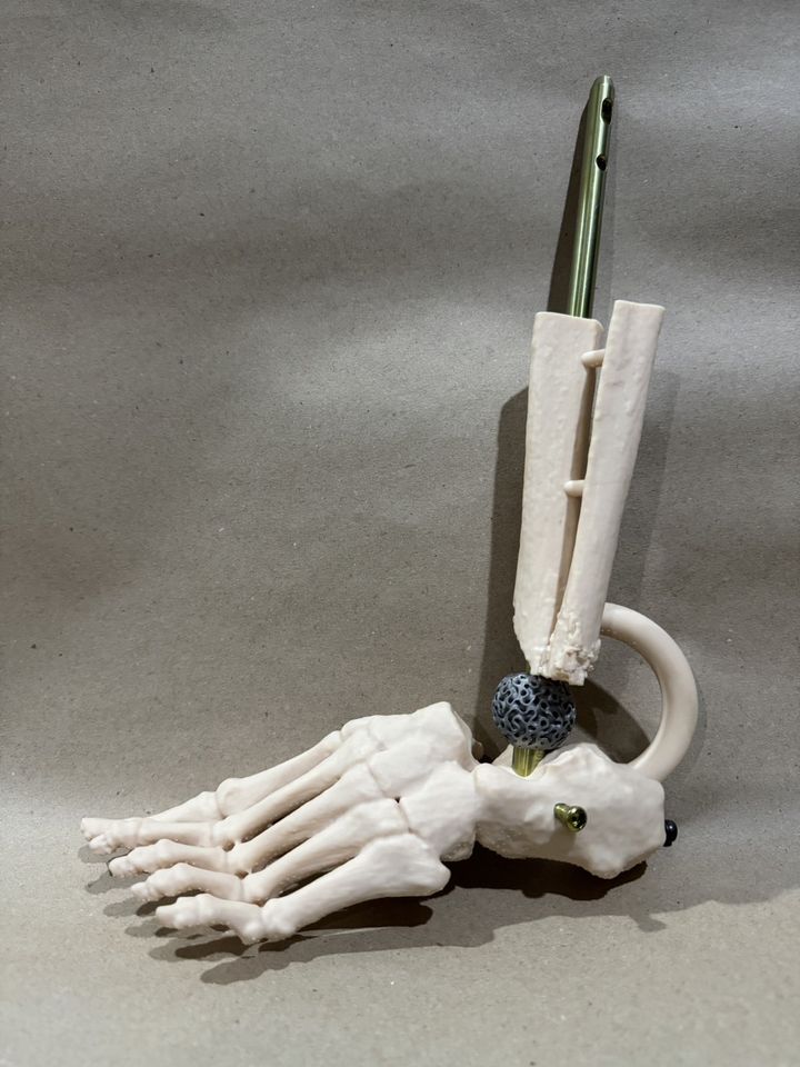 OsseoMatrix™ implant