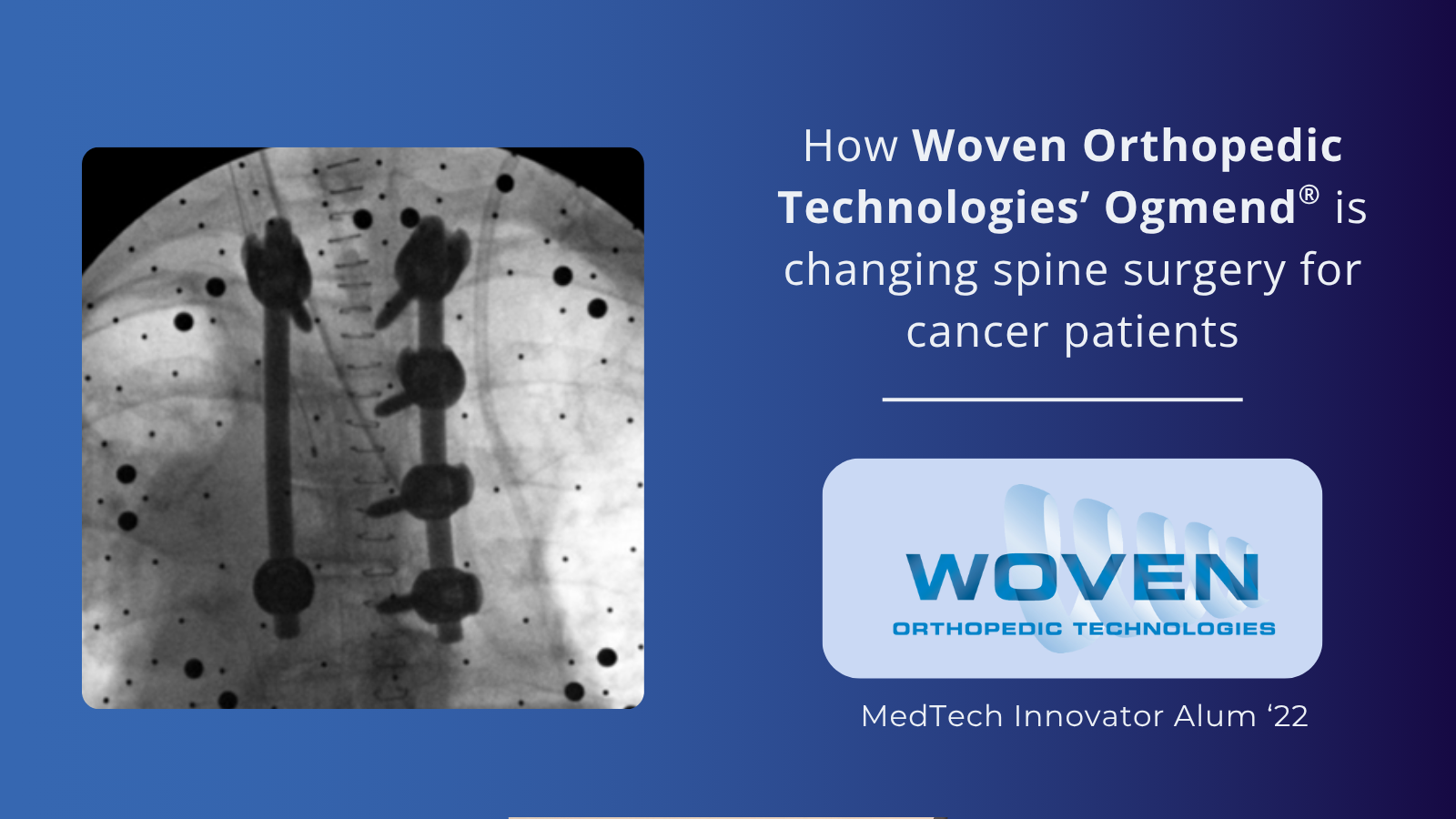 Woven Orthopedic Technologies patient story graphic