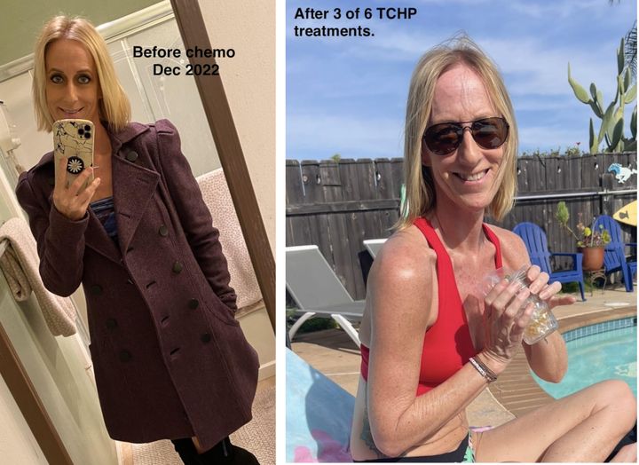 Cooler Heads patient before and during chemo