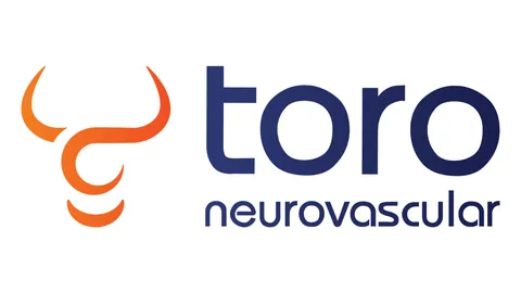 Toro Neurovascular Announces FDA 510(k) Clearance for Toro 88 Superbore Catheter