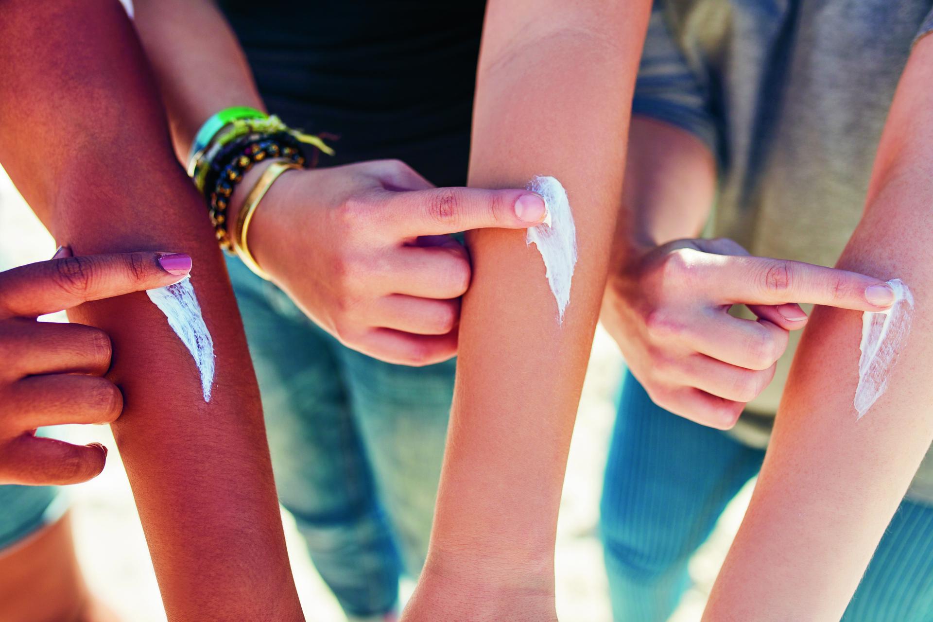 Zonnebrand op een arm