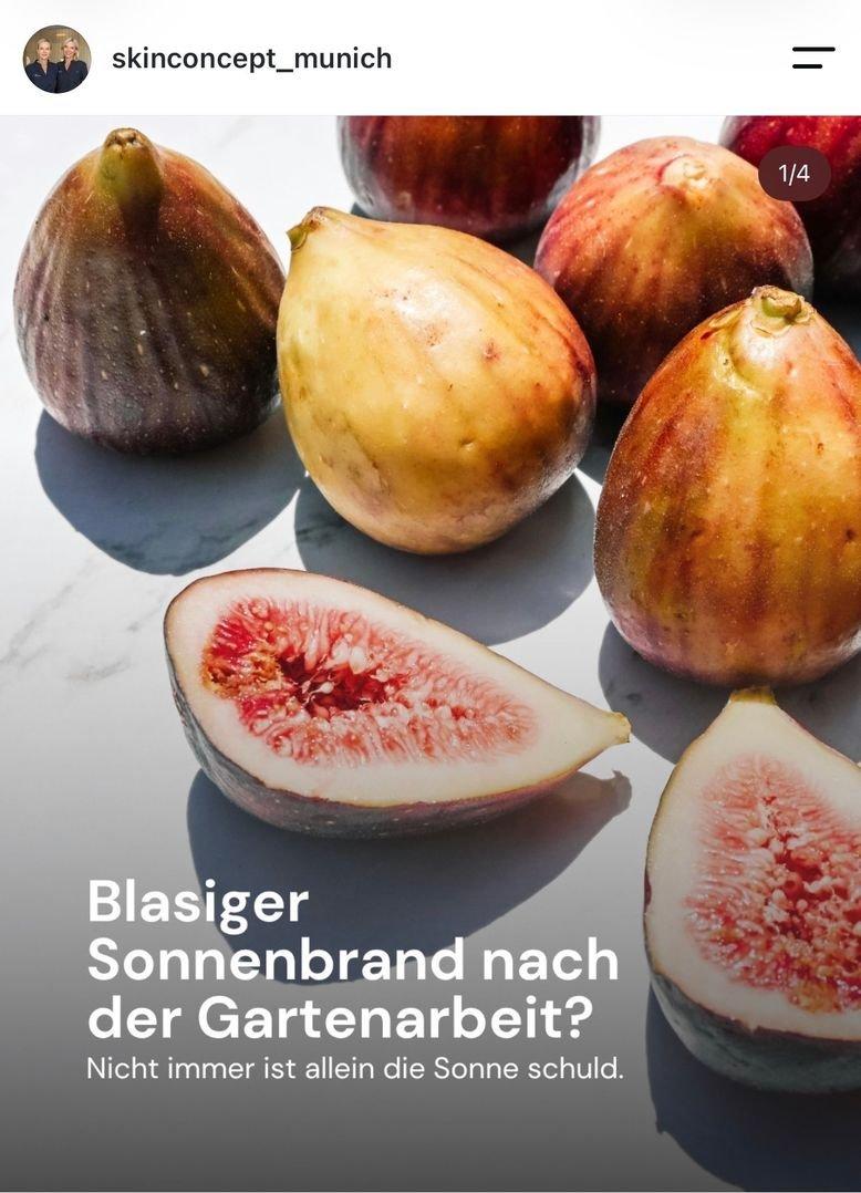 Instagram-Post für Skin Concept: Aufgeschnittene Feigen, „Blasiger Sonnenbrand nach der Gartenarbeit?“