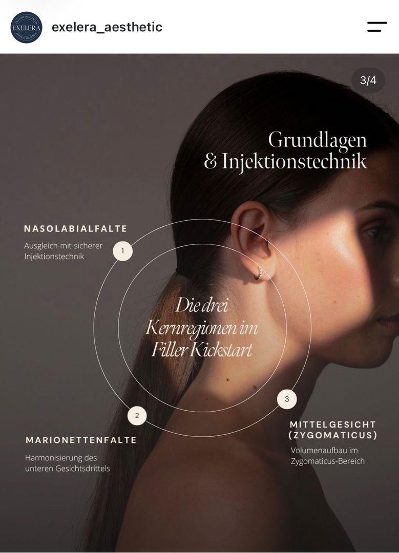 Instagram-Post für EXELERA®: Profil einer Frau mit Grafik zu drei Injektionsregionen