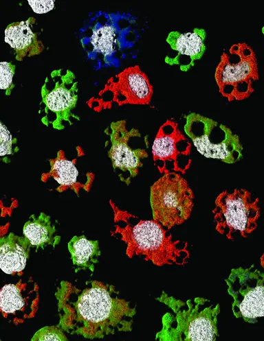Fluorescence microscopy image of cultured cells stained with multiple markers, representing alphavirus research, viral infection studies and diagnostic assay development.