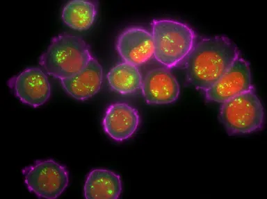 Fluorescently labelled cells representing mRNA production and RNA therapeutic research.