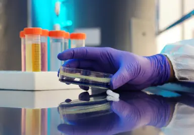 Gloved laboratory professional handling a sample dish beside specimen collection containers in a clinical testing laboratory, representing quality control procedures, sample integrity and toxicology laboratory testing.