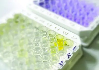 Microplate-based immunoassay demonstrating colour development in assay wells for diagnostic and biomarker research applications.
