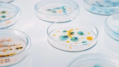 Petri dishes with microbial colonies in a laboratory setting.