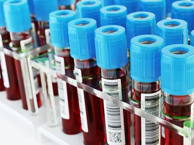 Sample Handling