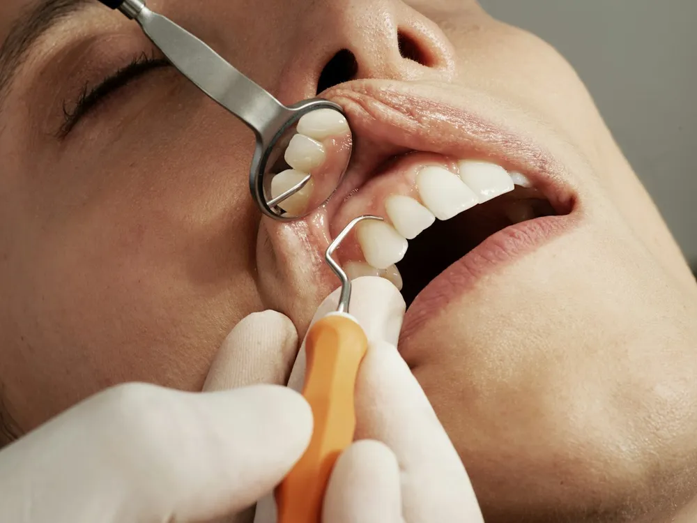 Limpieza dental: 2 por $50.000