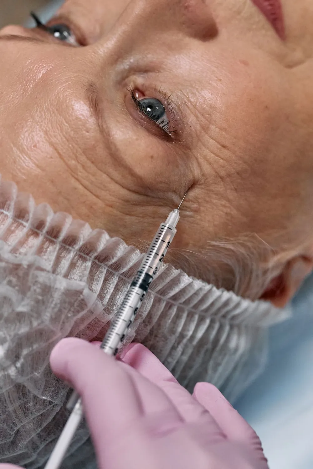 Armonización facial con bótox: qué es la toxina botulínica y cómo actúa