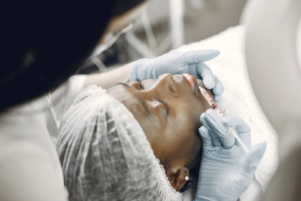 Hilos tensores: el lifting facial sin cirugía que está redefiniendo la armonización