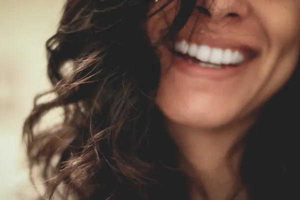 6 carillas dentales