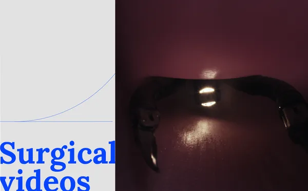 Surgical Staging for Endometrial Cancer