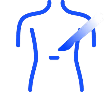 Line drawing of an abdomen