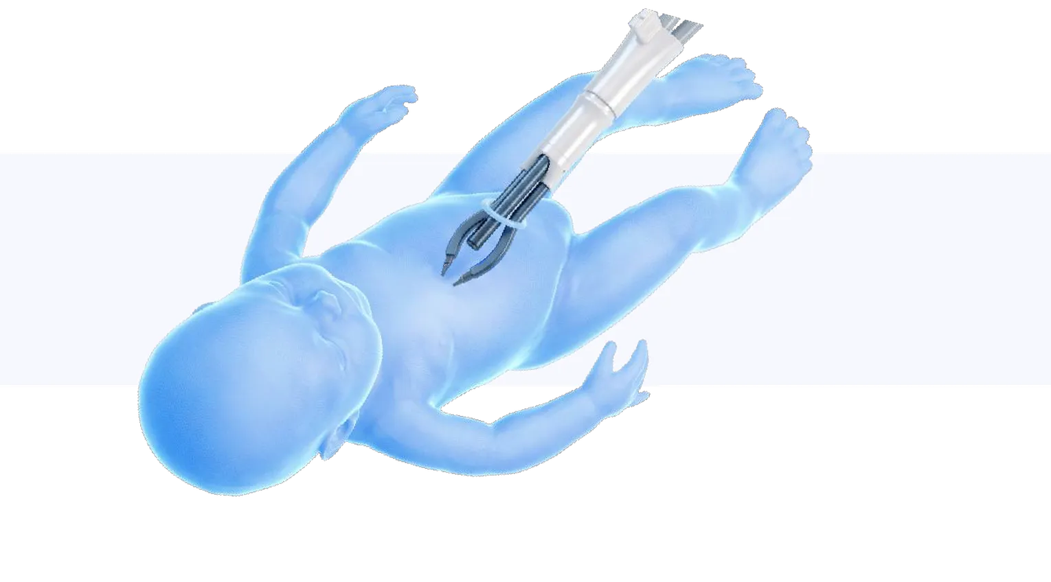 Single access point on a patient model