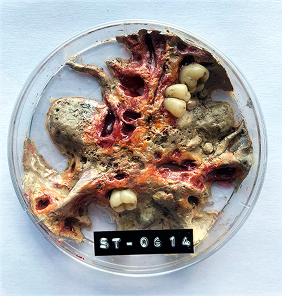 A plate with unidentifiable objects on it