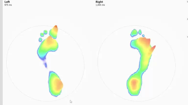 How Gait Analysis Can Benefit Runners | Carter & George