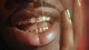 A close up of a person's mouth, with gold tooth gems on their teeth