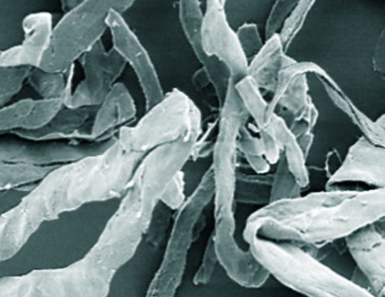 Shows a microscope image of cellulose