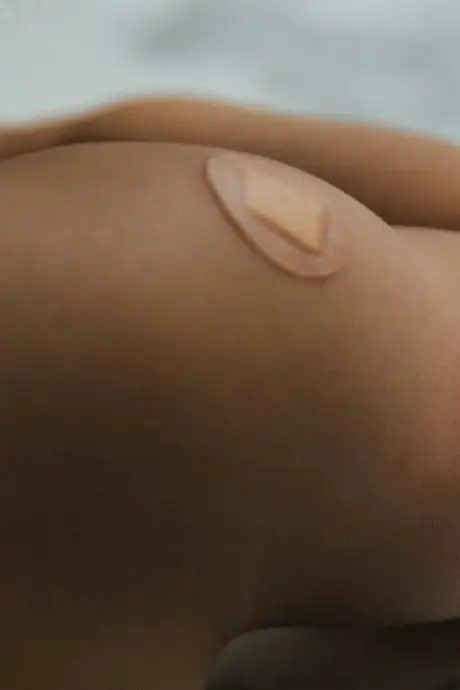 A Person with plasters on their arm and shoulder