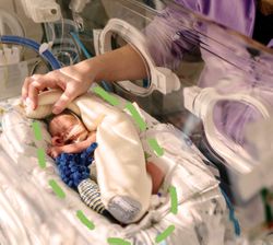 neonato nell'incubatrice di un ospedale