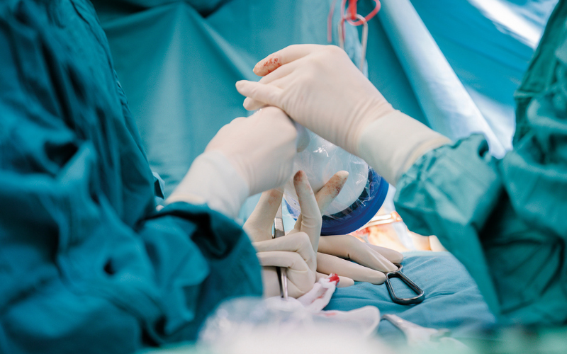 Während einer Operation