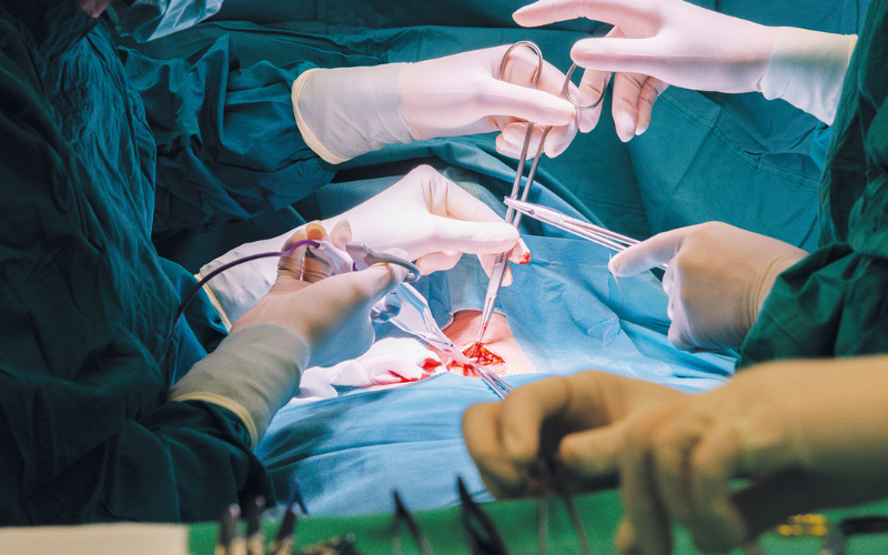 Drüse wird entnommen