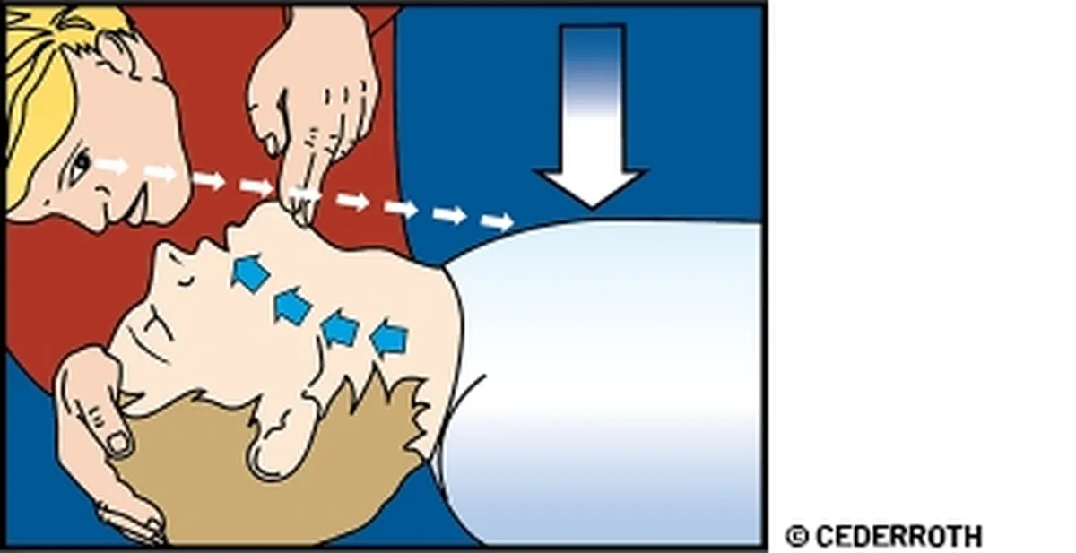 En person som håller en annan persons huvud och kontrollerar bröstkorgen efter mun till mun andning getts