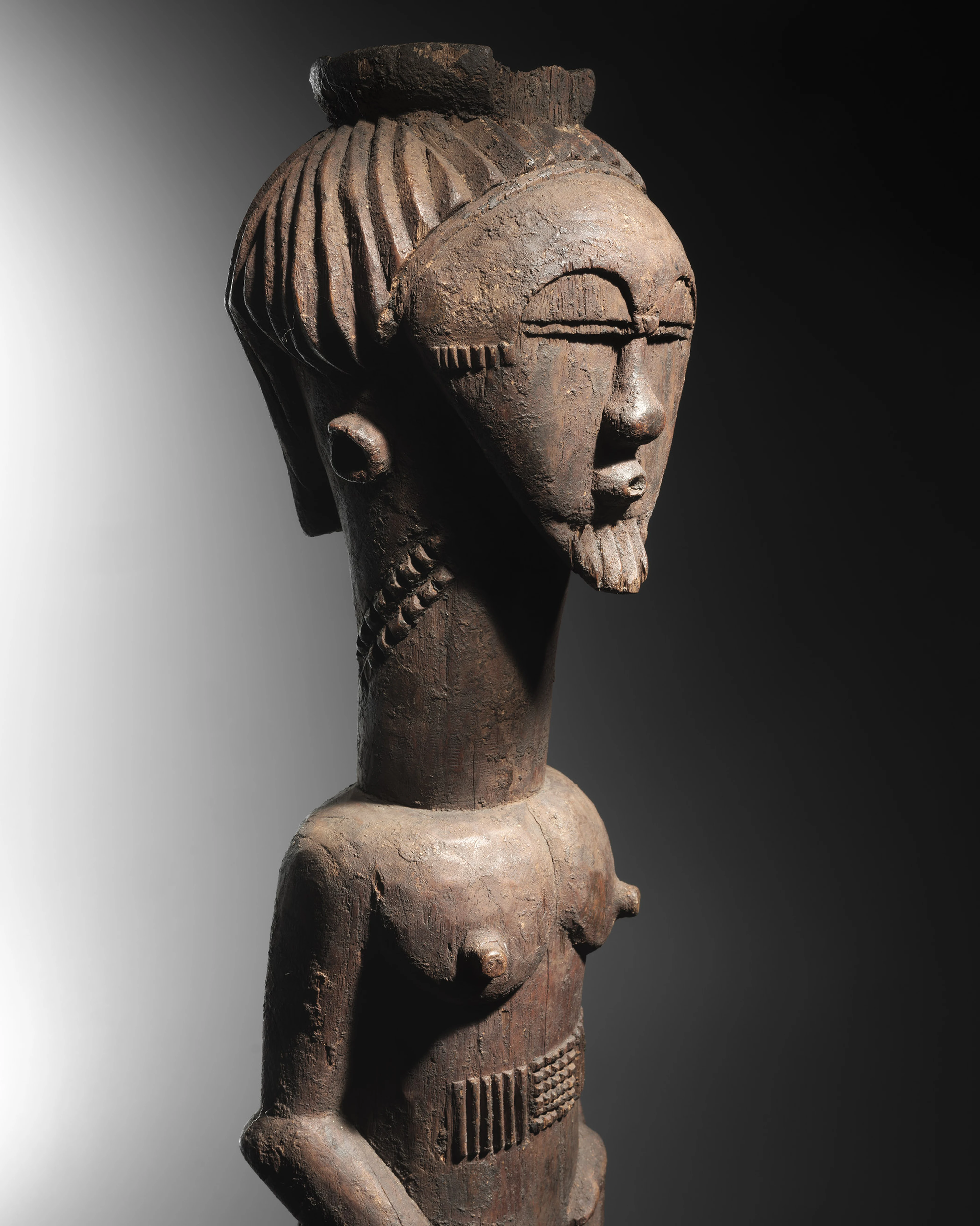 Attie Figure - 2