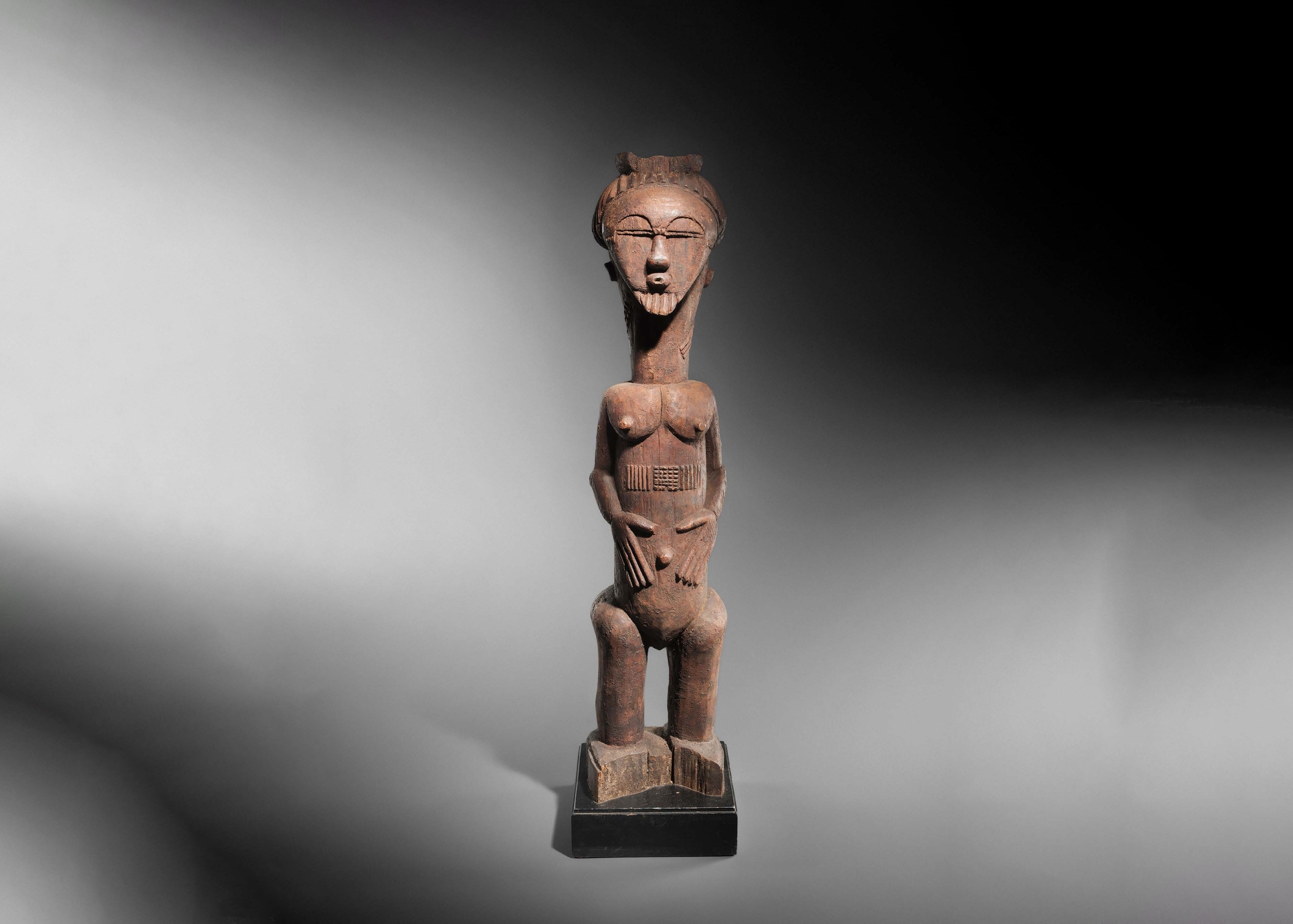 Attie Figure