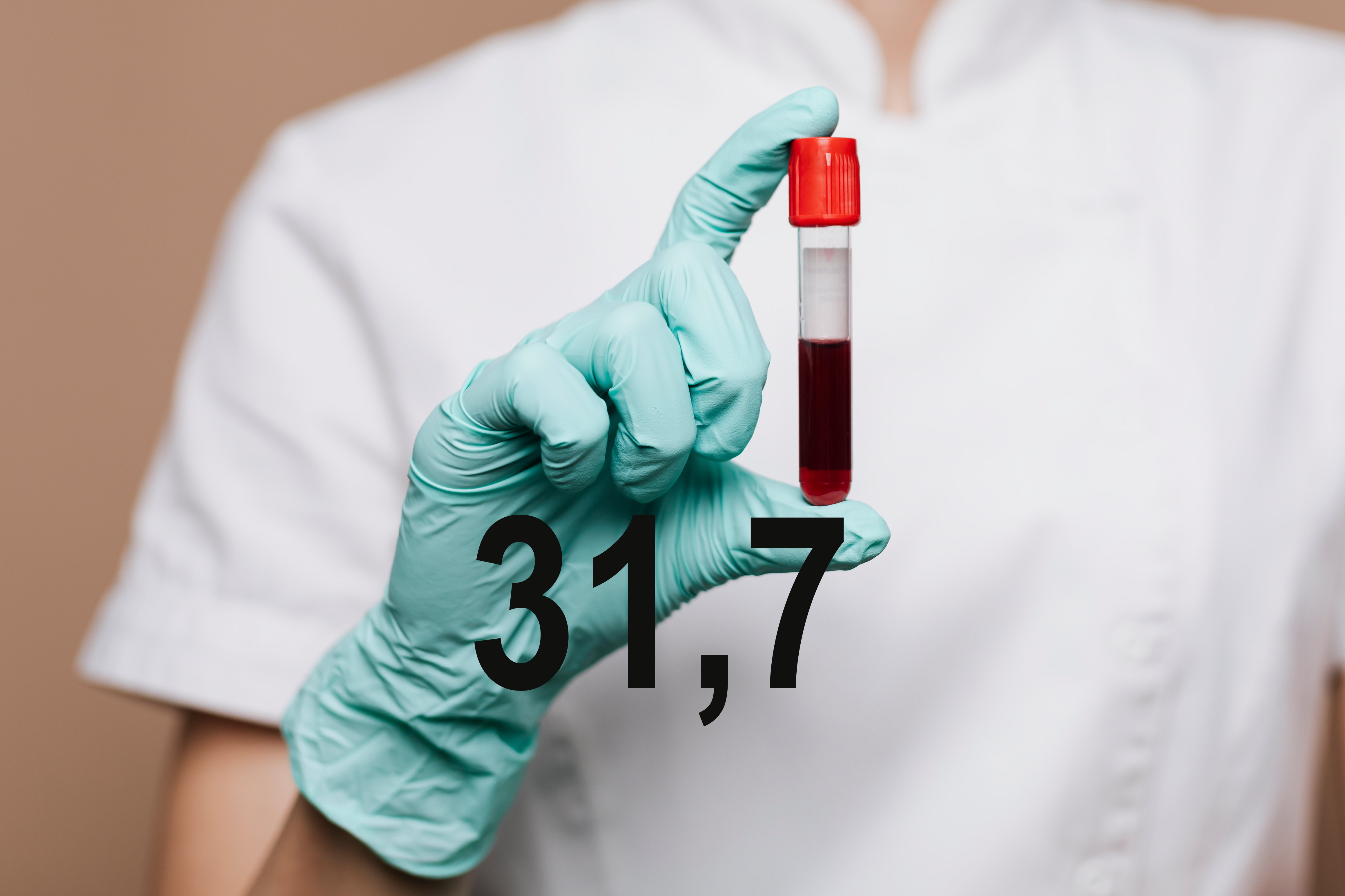 Symbolbild Blutprobe