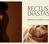 Rectus diastase na zwangerschap: herkennen en behandelen